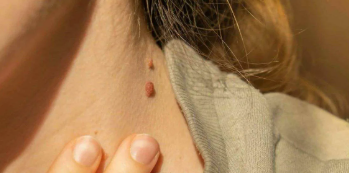 Menjaga kebersihan tubuh secara sistemik dari mikroorganisme merugikan seperti parasit